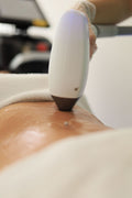Sessão de radiofrequência estética